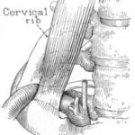 History of Thoracic Outlet Syndrome: Gould, Symonds, Yates and Guest