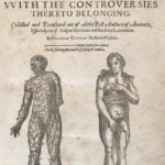 History of Thoracic Outlet Syndrome-Helkiah Crooke