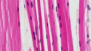History of Thoracic Outlet Syndrome: Machleder, Moll and Verity