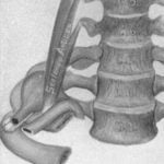 History of Thoracic Outlet Syndrome: H. Mayo