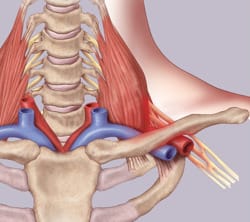 History of Thoracic Outlet Syndrome: R.M. Peet
