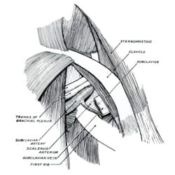 History of Thoracic Outlet Syndrome: Kenneth C. Eden