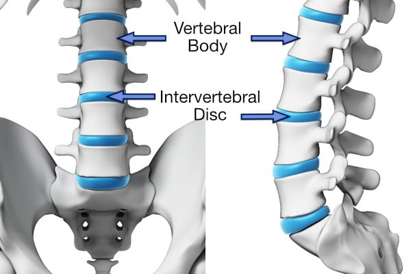 Vertebral bodies and intervertebral discs