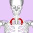 Thoracic outlet syndrome first rib resection major league baseball pitchers