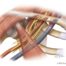 Brachial plexus, subclavian artery, and subclavian vein pass through the costoclavicular interval and retropectoralis space.