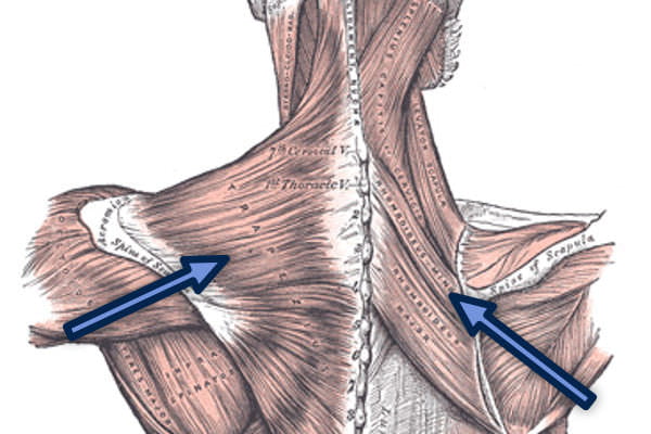 image409-Gray-Posterior Approach Surgical Treatment of Thoracic Outlet Syndrome-Posterior Approach