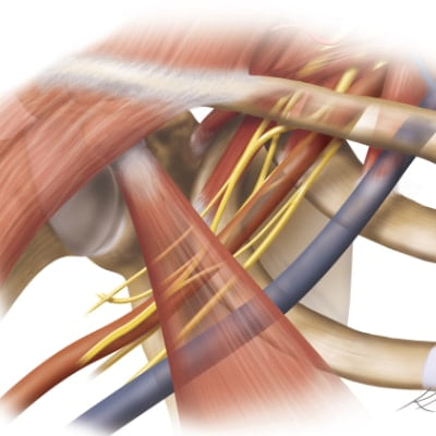 Anatomic drawing-pectoralis minor, brachial plexus, subclavian artery, and subclavian vein